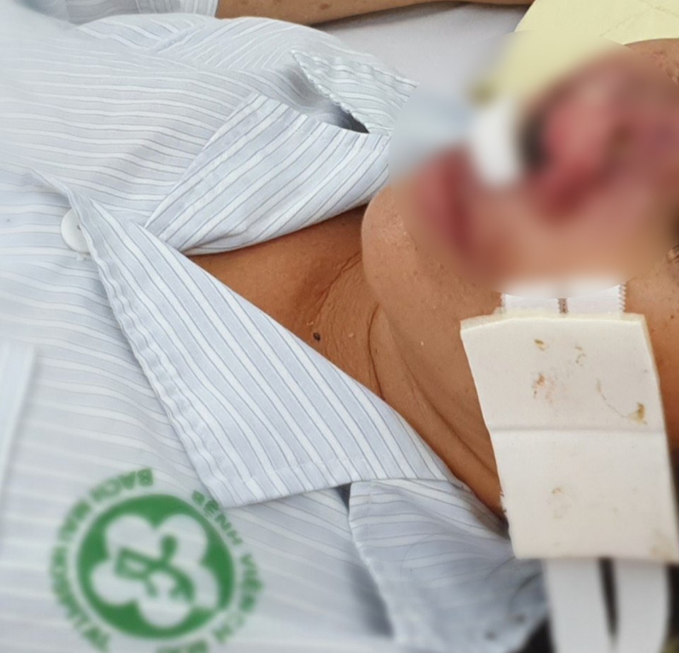 Hướng dẫn phòng tránh vi khuẩn ăn mòn cơ thể Whitmore