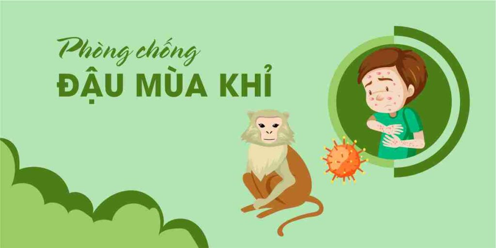 CHỦ ĐỘNG PHÒNG CHỐNG BỆNH ĐẬU MÙA KHỈ