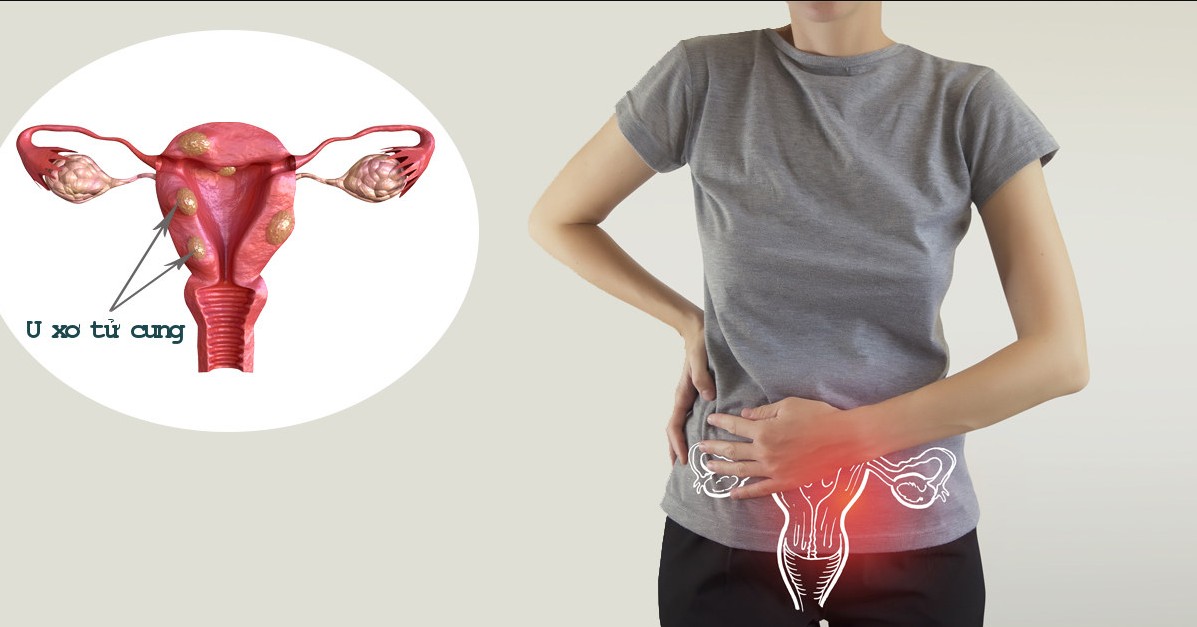 Cảnh Báo: Rong Kinh Kéo Dài Là Dấu Hiệu Của Bệnh Gì?